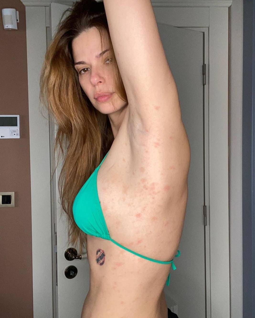 Vücudunu göstererek yakalandığı hastalığı paylaştı! Takipçileri kahroldu... 5